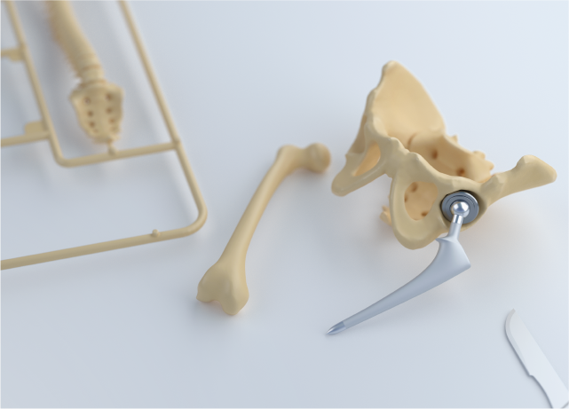 Covergestaltung eines künstlichen Kugelgelenks als 3D-Visualisierung