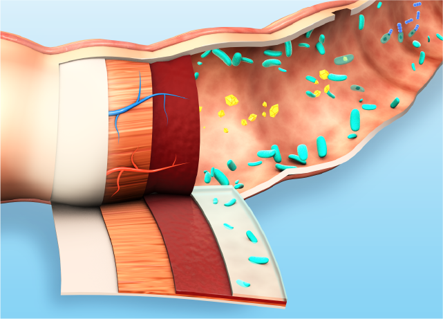 Eine Infografik zur Verdauung mit einer 3D-Grafik des Dickdarms.